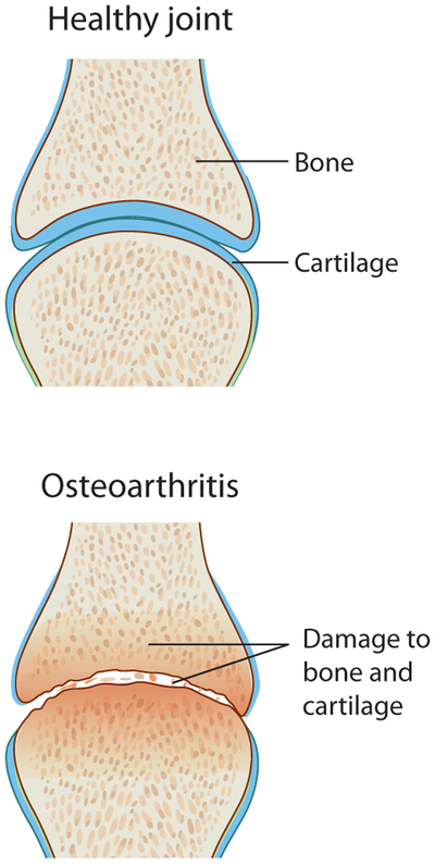 Figure 1: