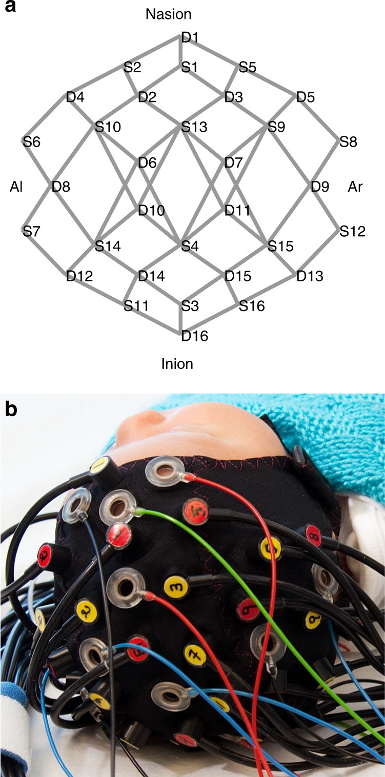 Fig. 1