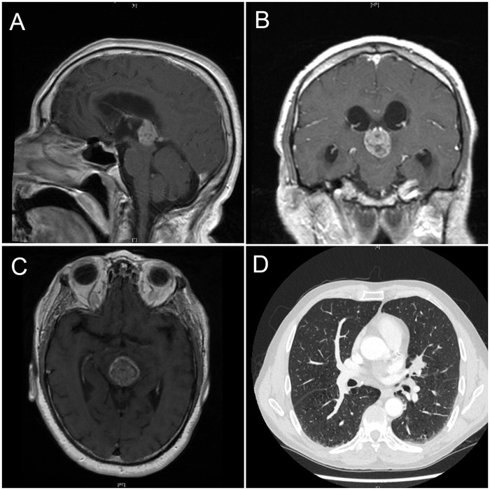 Figure 1.