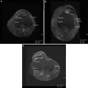 Fig. 6
