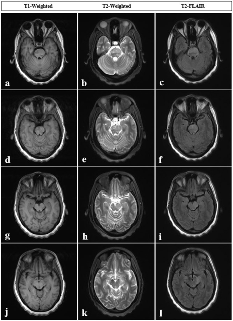 Fig 2