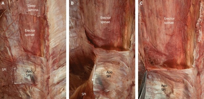 Fig. 12