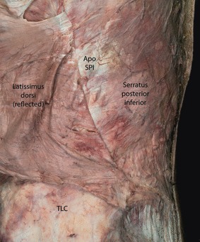 Fig. 11