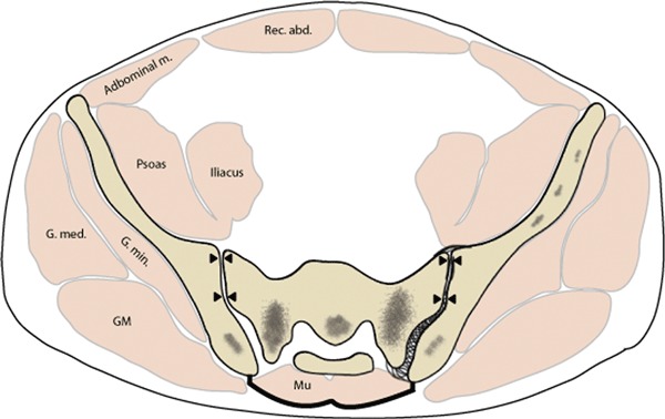 Fig. 20