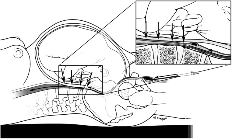 Figure 1: