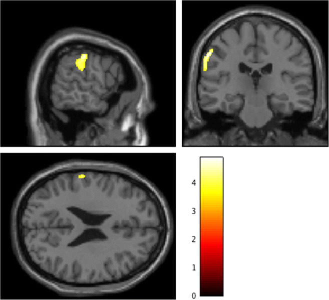 Fig. 2