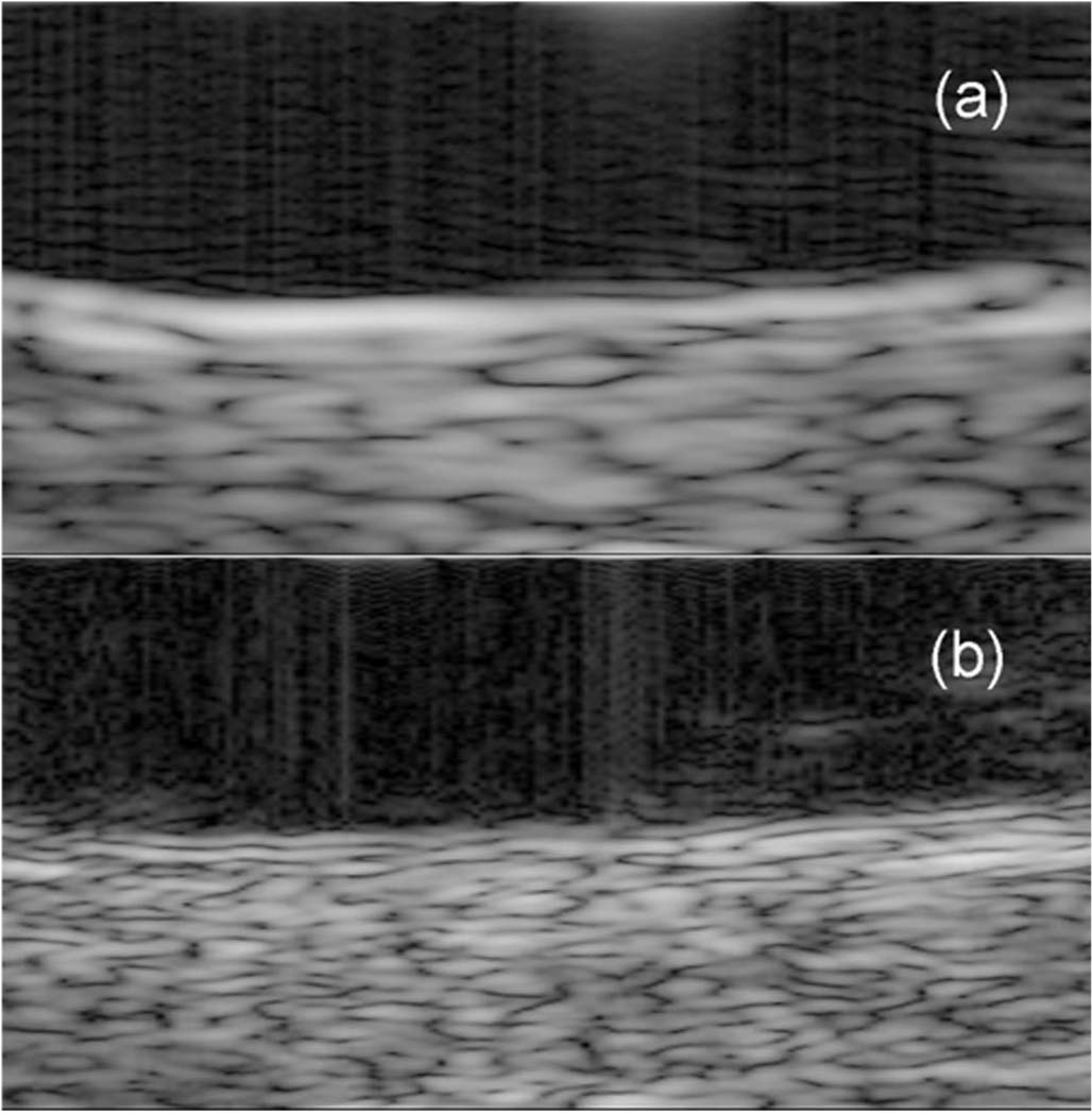 Fig. 10