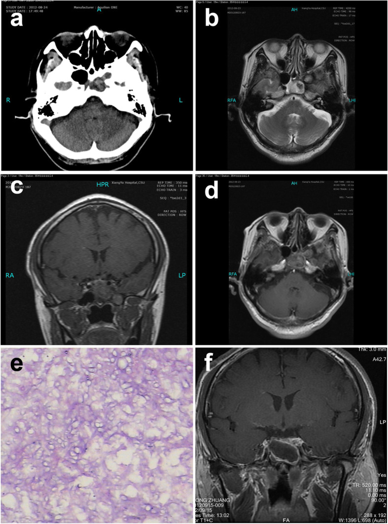 Fig. 2
