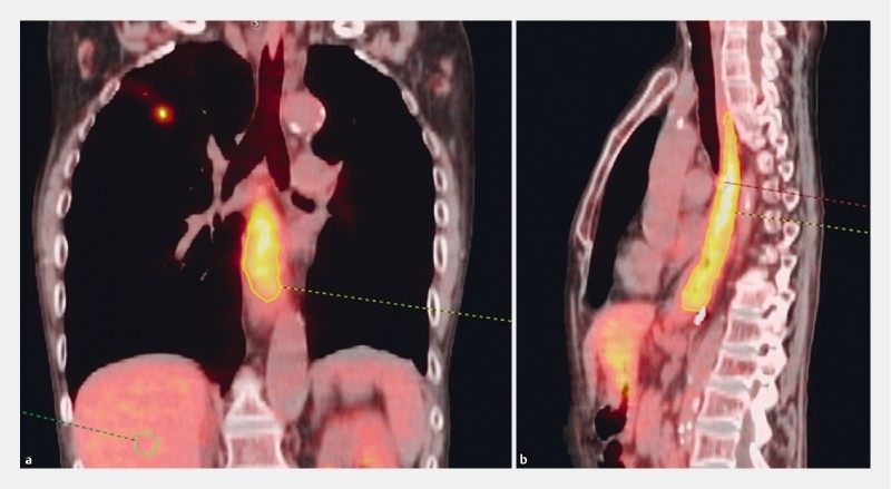 Fig. 4