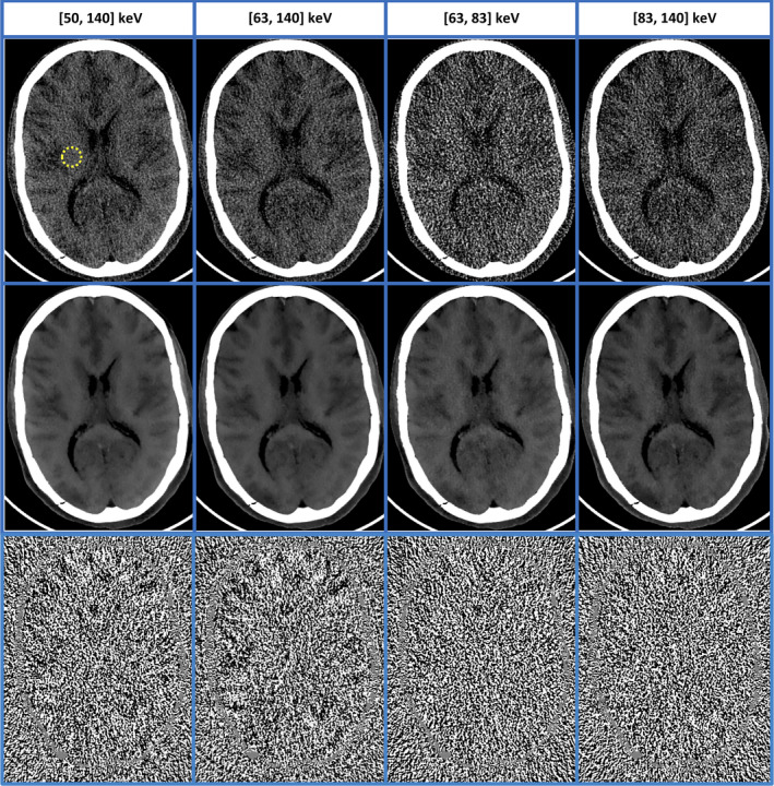 Figure 13