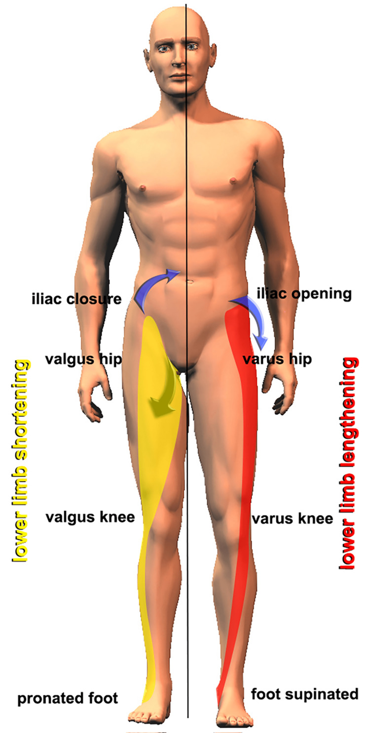 Figure 17