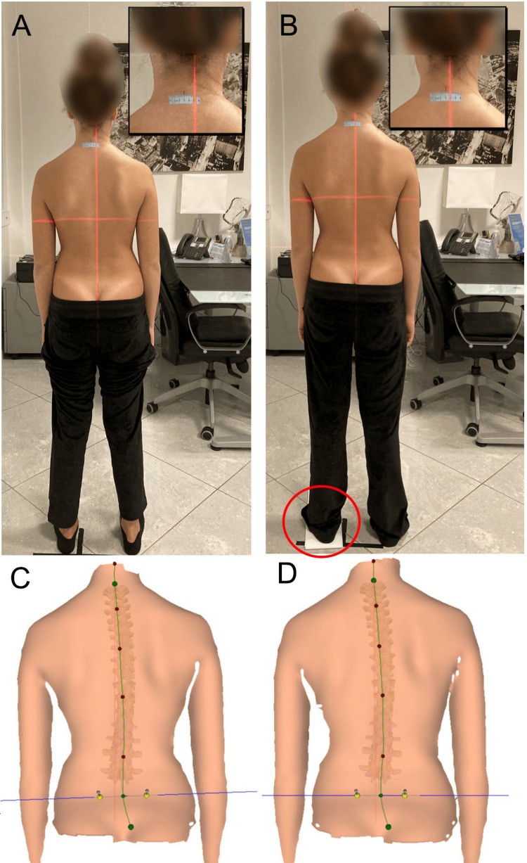 Figure 23