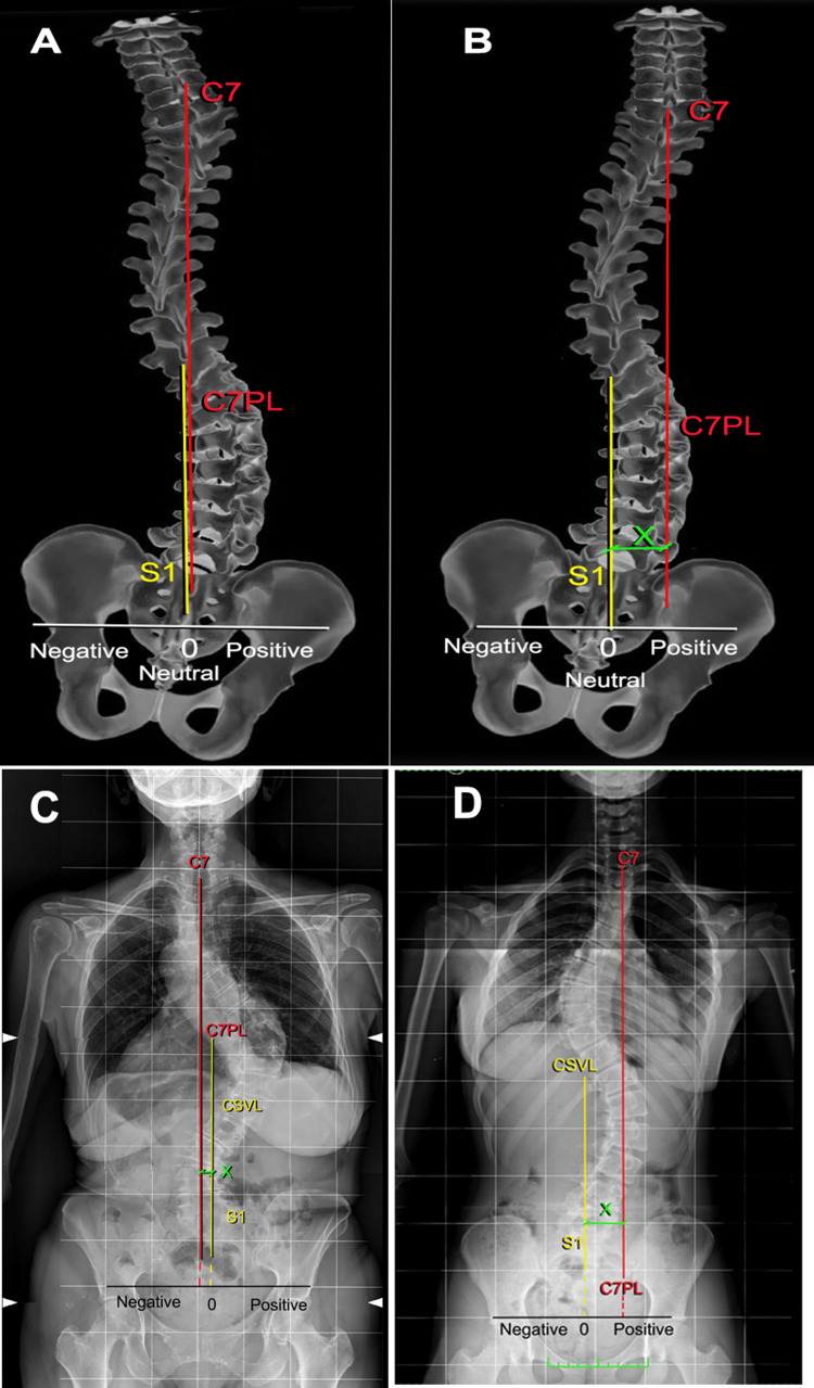 Figure 20