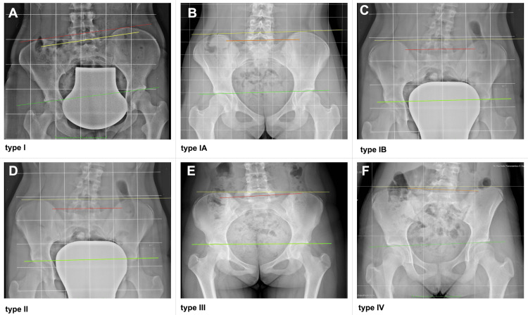 Figure 19