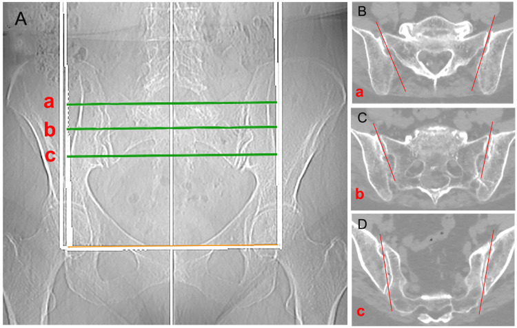 Figure 15