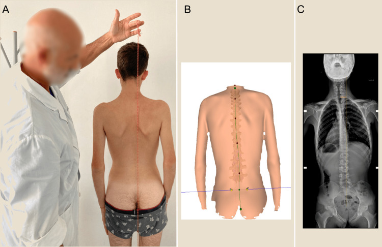 Figure 22