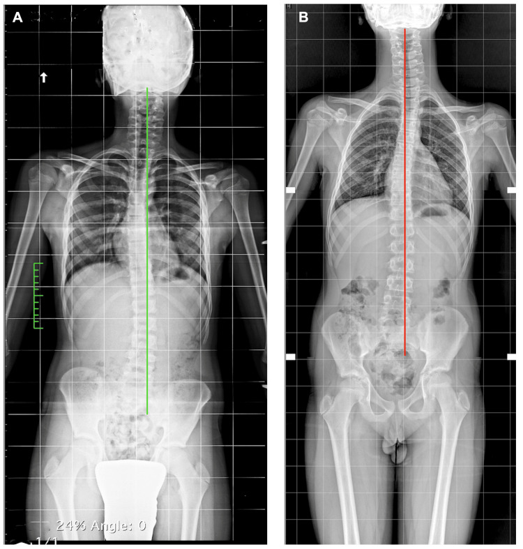 Figure 21