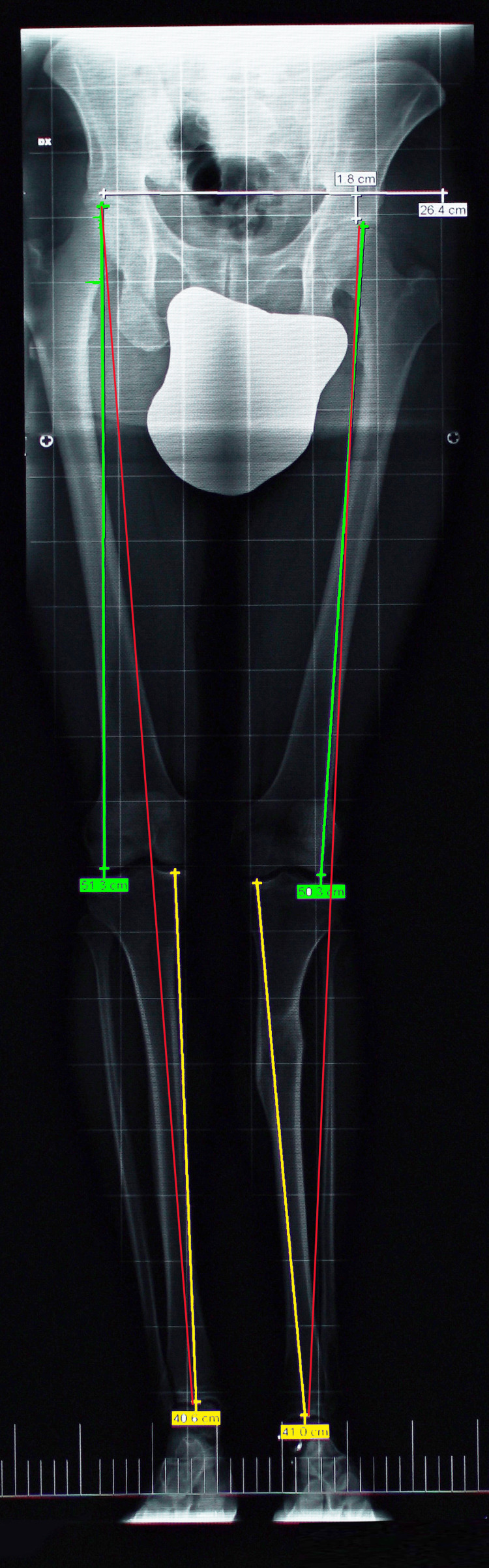 Figure 12