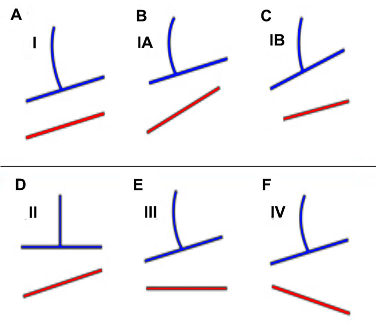 Figure 18
