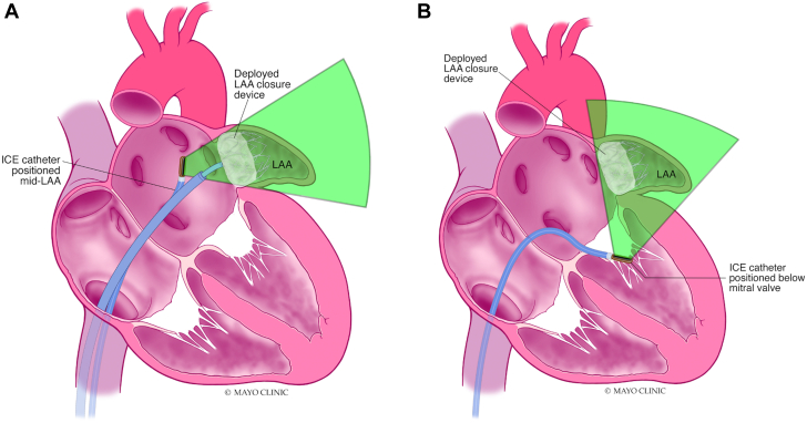 Figure 10