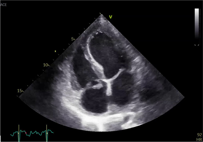 Fig. 2