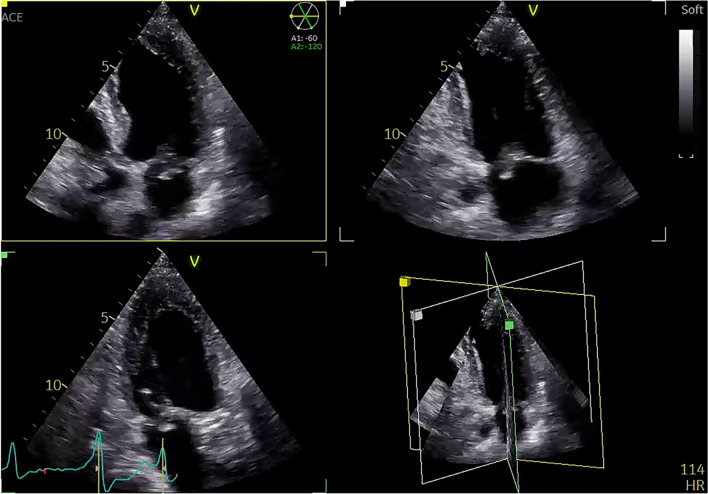 Fig. 1