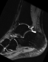 Figure 7b: