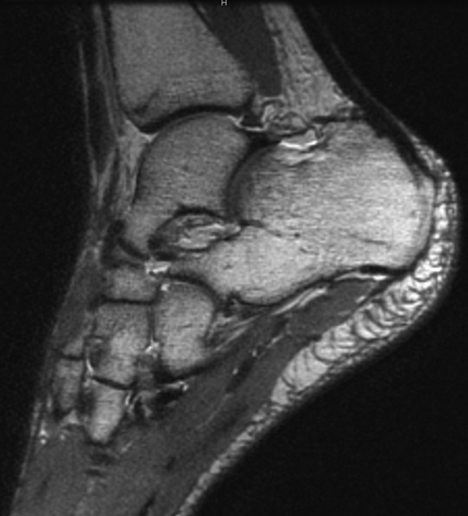 Figure 3a: