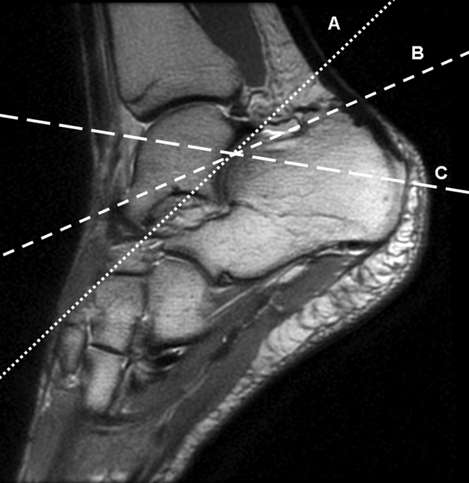 Figure 4d: