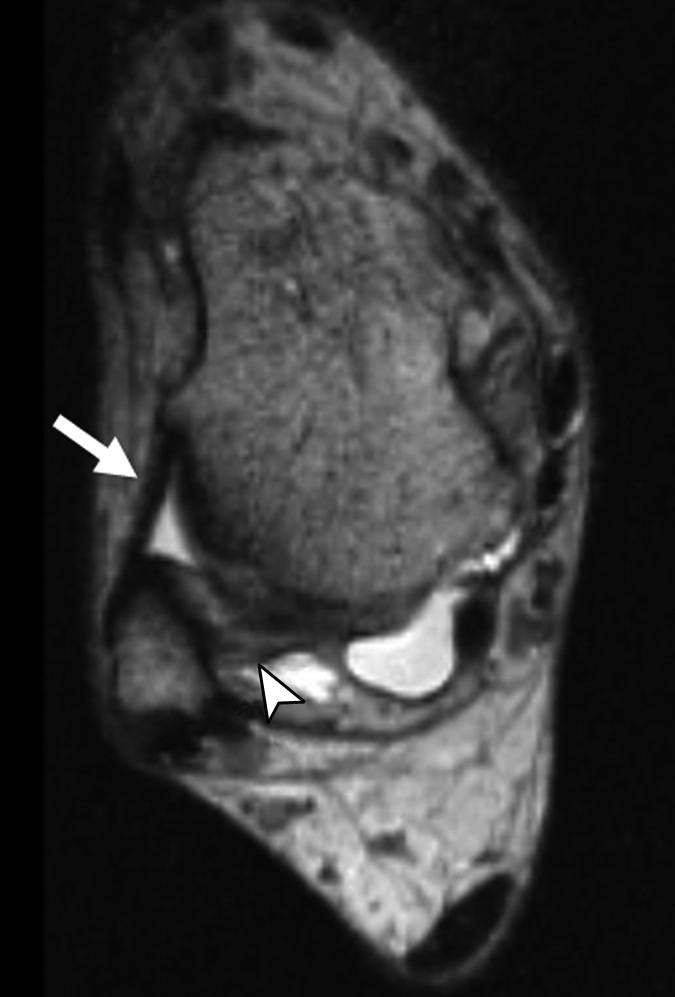 Figure 4b: