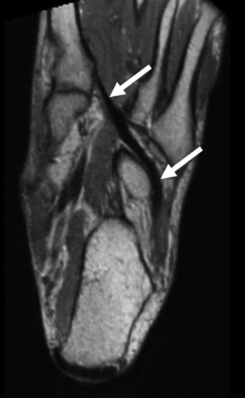 Figure 5c: