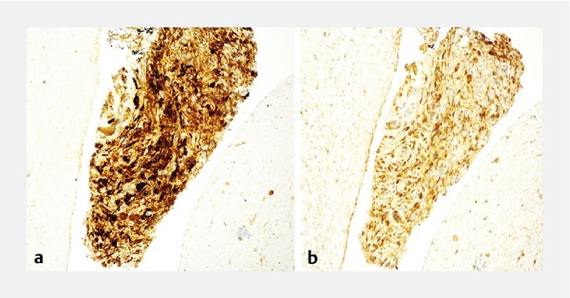 Fig. 2