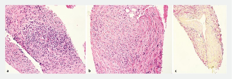 Fig. 1