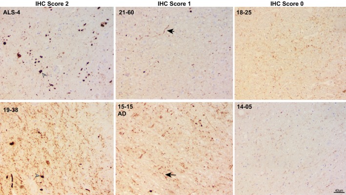 FIGURE 3