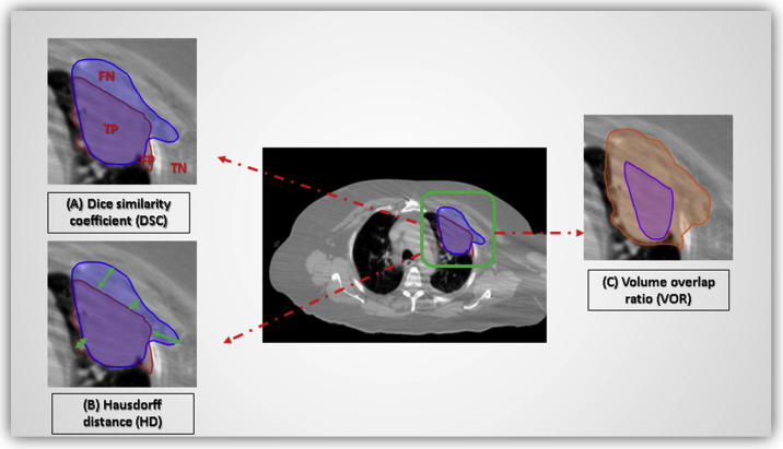 Fig. 3