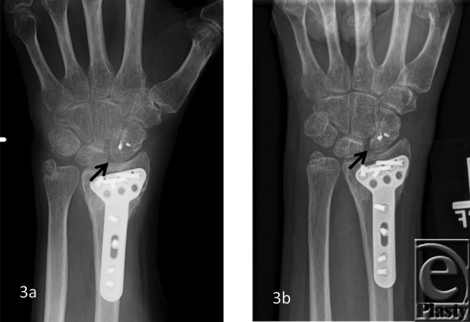 Figure 3a, b.