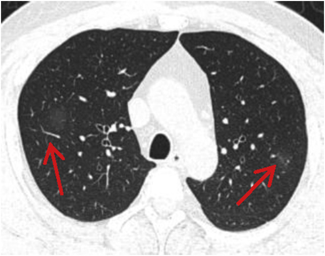 Fig. 1