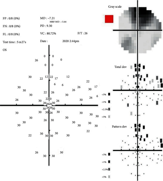 Figure 4