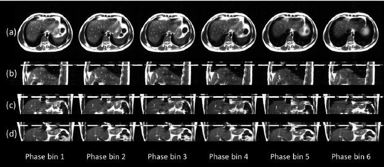 FIG. 11.