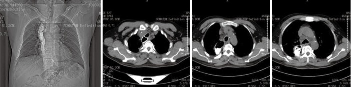 Figure 17