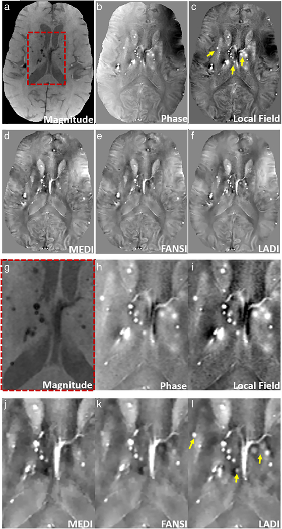 FIGURE 3: