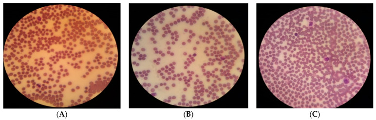 Figure 11