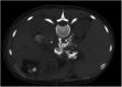 <b>FIG. 2.</b>