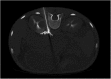 <b>FIG. 1.</b>