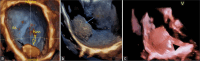 Figure 3: