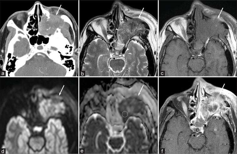 Figure 1: