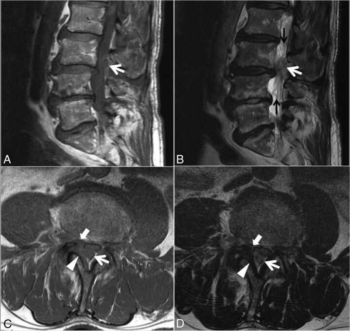 Fig 4.