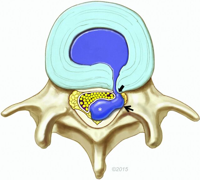 Fig 1.