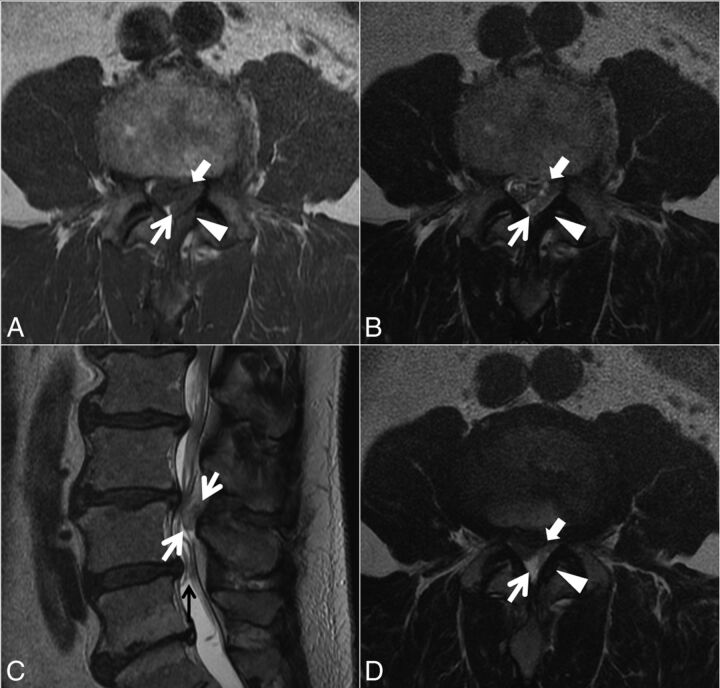 Fig 6.