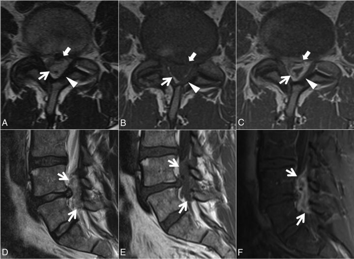 Fig 2.